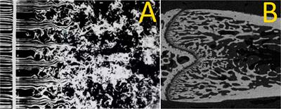 Resolving trabecular metaphyseal bone profiles downstream of the growth plate adds value to bone histomorphometry in mouse models